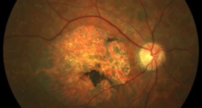 Recently @Retina Latest News