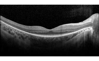 Recently @Retina Latest News